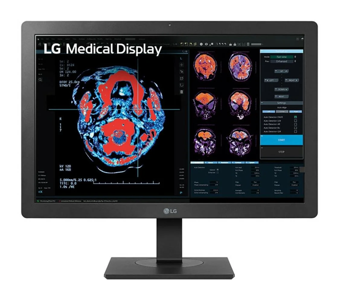 Monitor Consumer LG 24HR513C-B, 24", 1920 x 1200 pixeli, Black, 3 ani Garantie LG